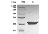 Recombinant Human NGAL/Lipocalin-2 Protein (His Tag, E.coli)