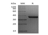 Recombinant Human N-Glycosylase/OGG1 Protein (GST Tag)