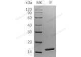 Recombinant Human SNU13 Protein (His Tag)