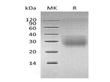 Recombinant Human NKG2A & CD94 Heterodimer Protein (His & Flag Tag) 