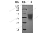 Recombinant Human CD159a/KLRC1 Protein (His Tag)(Active)