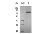 Recombinant Human NKG2DL/ULBP-1 Protein (Fc Tag) 