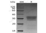 Recombinant Human ULBP2/N2DL-2 Protein (His Tag)