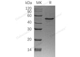 Recombinant Human NDRG1 Protein (His Tag)