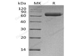 Recombinant Human NgR3/RTN4RL1 Protein (His Tag)