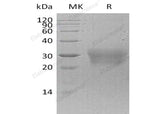 Recombinant Human NPDC-1/NPDC1 Protein (His Tag)