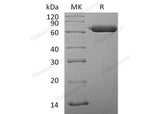 Recombinant Human SGSH Protein (His Tag)