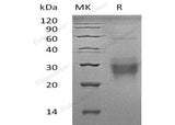 Recombinant Human NFYA Protein (GST Tag)