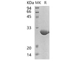 Recombinant Human NOL3 Protein