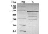 Recombinant Human NOL3 Protein (GST Tag)