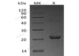 Recombinant Human NHP2/NOLA2 Protein (His Tag)