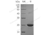 Recombinant Human NME1/NDKA Protein (His Tag)