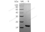 Recombinant Human Oncomodulin-1/OCM Protein (His Tag)