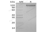 Recombinant Human OSMR/IL31RB Protein (aa 28-739, His Tag)