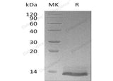 Recombinant Human Osteocrin/OSTN Protein (His Tag) 