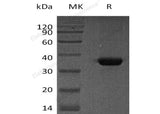 Recombinant Human Osteonectin/SPARC Protein (His Tag)