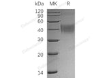 Recombinant Human OX-2/MOX1/CD200 Protein (His Tag)