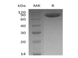 Recombinant Human OX-2/MOX1/CD200 Protein (Fc Tag)