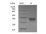 Recombinant Human TNFSF4/OX40L Protein (His Tag)(Active)