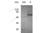 Recombinant Human OX40/TNFRSF4 Protein (Fc Tag)(Active)