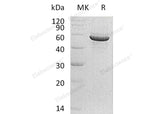 Recombinant Human PACSIN1/Syndapin-1 Protein (His Tag)