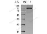 Recombinant Human PACSIN2/Syndapin-2 Protein (His Tag)