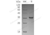 Recombinant Human PAFAH1B2/PAFAHB Protein (His Tag)