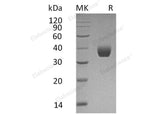 Recombinant Human PPT1 Protein (His Tag)