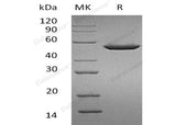 Recombinant Human PNLIPRP1/PLRP1 Protein (His Tag)