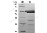 Recombinant Human Galactolipase/PLRP2 Protein (His Tag)