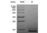 Recombinant Human PPY Protein (His Tag)