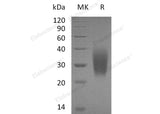 Recombinant Human PTH1R Protein (Gly49, His Tag)