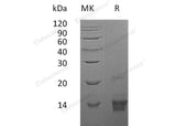 Recombinant Human Parathyroid Hormone/PTH Protein (1-84)