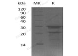 Recombinant Human PYM1/WIBG Protein (His Tag)