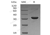 Recombinant Human PBLD/MAWBP Protein (His Tag)