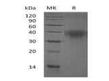 Recombinant Human PD-1/PDCD1 Protein (His Tag)(Active)