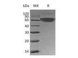 Recombinant Human PD-1/PDCD1 Protein (mFc Tag)(Active)