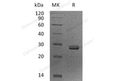 Recombinant Human PDCD10/TFAR15 Protein