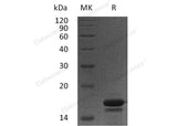 Recombinant Human PDCD5/TFAR19 Protein (His Tag)