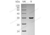 Recombinant Human PDAP1/PAP Protein (His Tag)