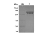 Recombinant Human PD-L1/B7-H1/CD274 Protein (Fc Tag) 