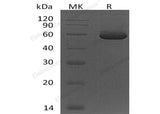 Recombinant Human Peptidase D/PEPD Protein