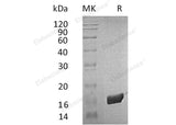 Recombinant Human FKBP2 Protein (His Tag)