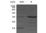 Recombinant Human FKBP3/FKBP25 Protein (His Tag)