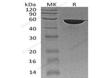 Recombinant Human FKBP4 Protein (His Tag)