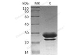 Recombinant Human PPIase/FKBP7 Protein (aa 24-222, His Tag)