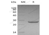 Recombinant Human Peroxiredoxin 1/PRDX1 Protein (His Tag)