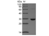 Recombinant Human Peroxiredoxin-4/PRDX4 Protein (His Tag)