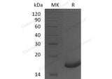 Recombinant Human Peroxiredoxin 5/PRDX5 Protein (His Tag)