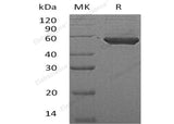 Recombinant Human PIP4K2A Protein (His Tag)